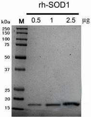 Recombinant Human Copper, Zinc-Superoxide Dismutase (rh-SOD1)